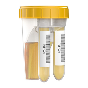 Non-Sterile Dual Urine Collection Cup 60mL Needleless